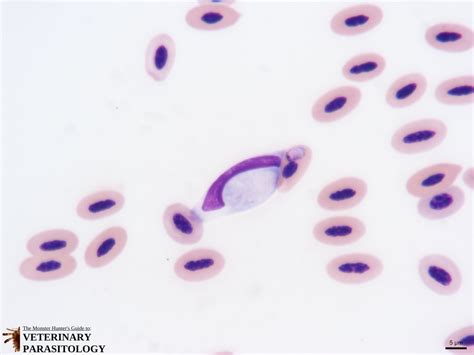  Leucocytozoon！  この寄生虫は鳥の血液中に潜んでいて、時には致命的な病気をもたらすこともあるのです